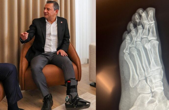 Özgür Özel’in ayak röntgeni paylaşıldı