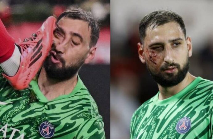 Donnarumma’nın yüzü darmadağın oldu