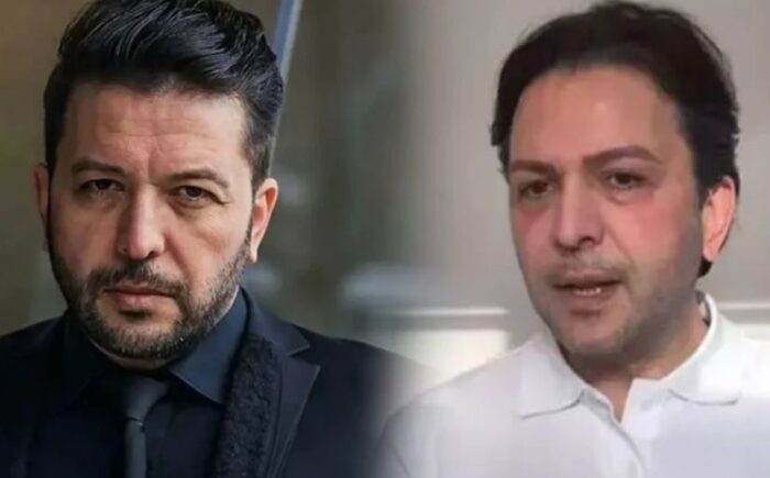 Nihat Doğan da estetik kervanına katıldı!